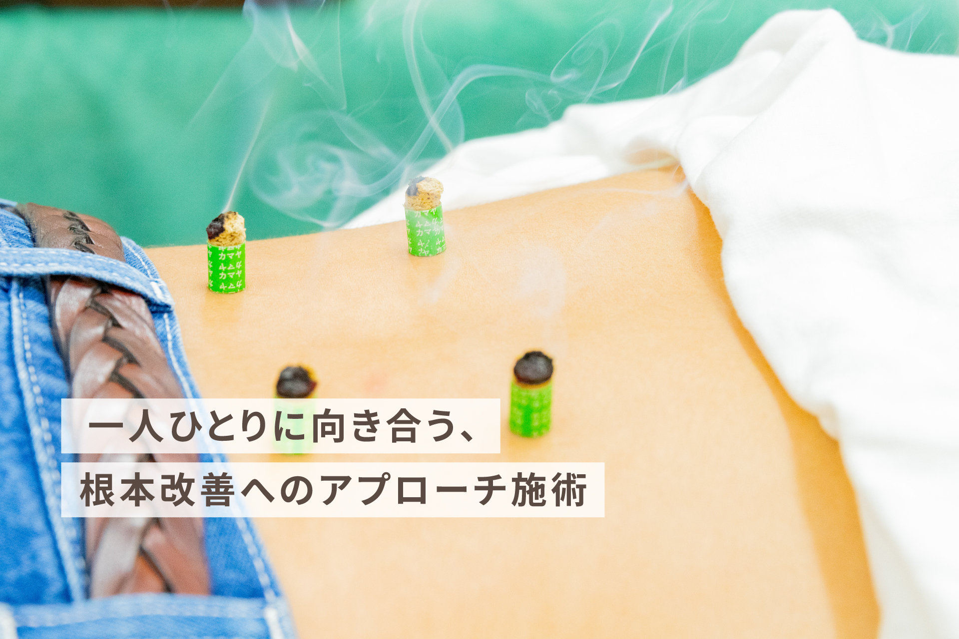 お灸施術を受ける背中